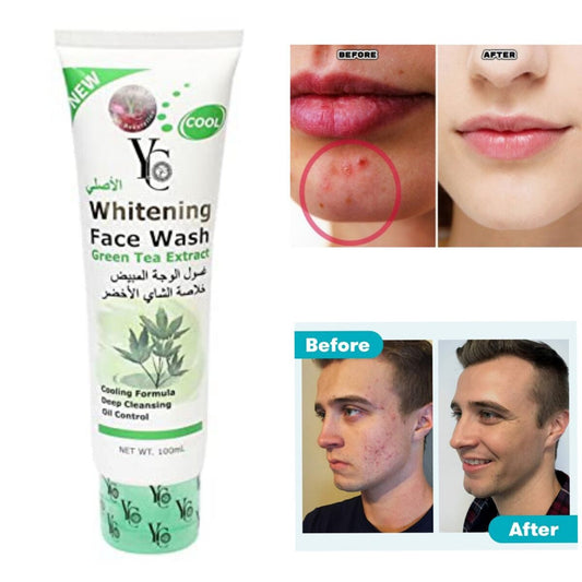 YC Whitening Face Wash for Oily Skin with Green Tea – 100ml