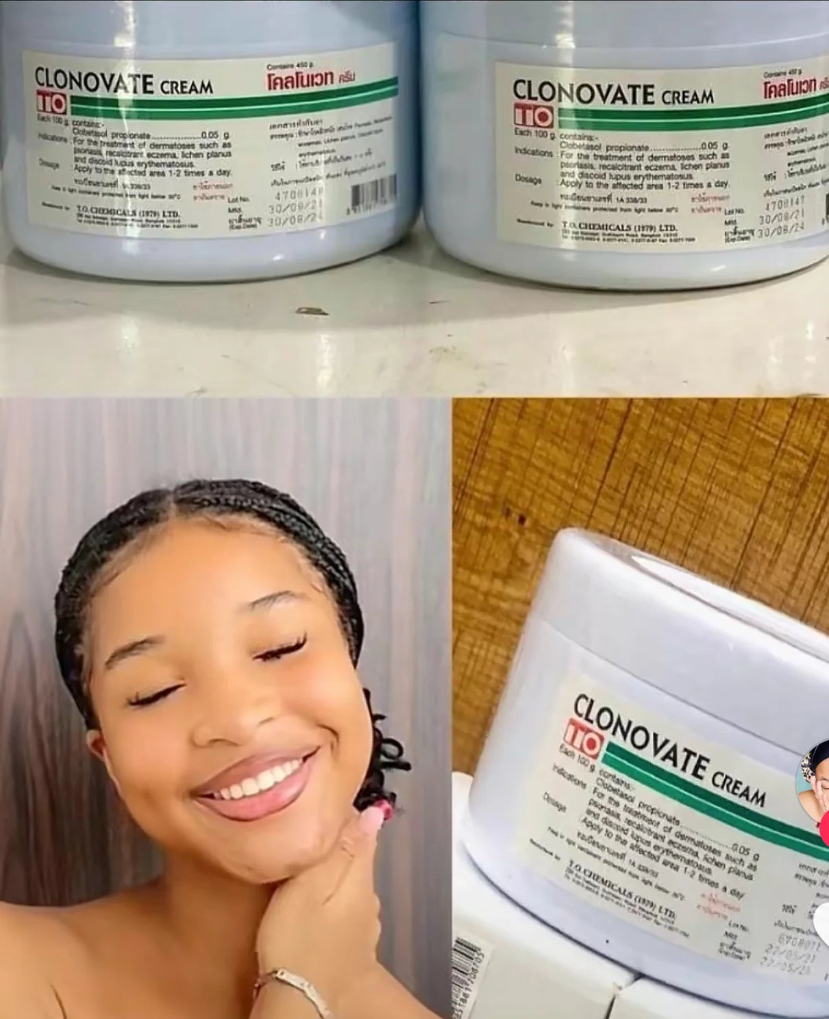 🔥 LIMITED DEAL — Clonovate 450g Body Whitening & Lightening Cream | Hyperpigmentation + Eczema + Dark Hands & Feet | KSh 4500 ( (