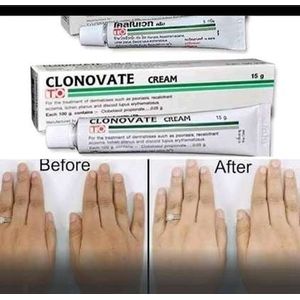 Clonovate Skin Lightening Cream-15g Very Effective