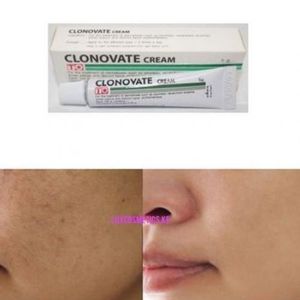 Clonovate Skin Lightening Cream-15g Very Effective