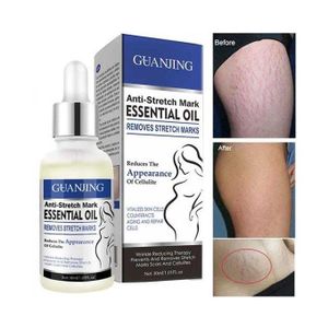 Guanjing Anti-stretch Mark Essential oil