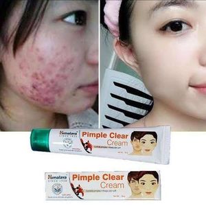 Himalaya Pimple Clear Cream