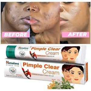 Himalaya Pimple Clear Cream