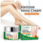 Guanjing Varicose Vein Cream Spider Varicose Vein Cream Improves Blood