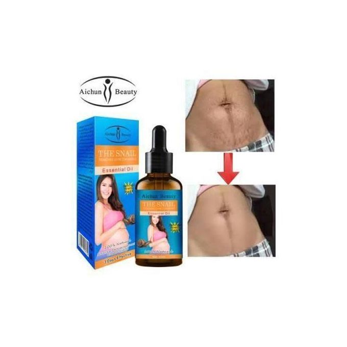 Aichun Beauty Stretch Marks Remover Essential Oil Skin Care 30ML