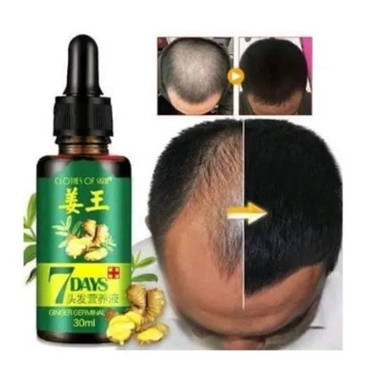 Clothes Of Skin 7Days Ginger Germinal Essential Hair Growth Oil For Hair Loss/Hair Treatment-For Both Men&Women30ml