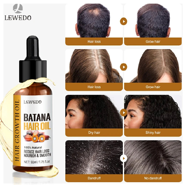 🔥 LIMITED DEAL — Lewedo Natural Batana Oil | Stimulates Hair Growth + Reduces Breakage + Deep Scalp Nourishment | KSh 2,500