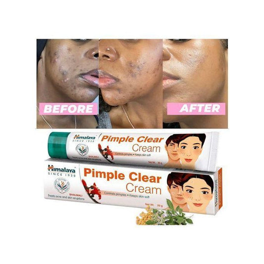 Himalaya Pimple Clear Cream