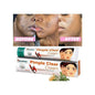 Himalaya Pimple Clear Cream