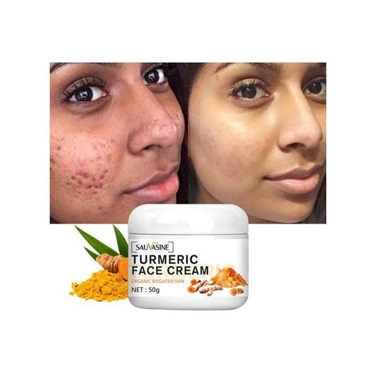 Sauvasine Turmeric Brightening Face Cream Treats Acne & Dark Spots