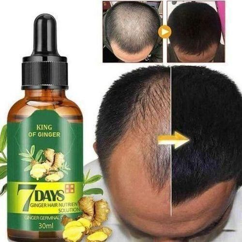 🔥 SALE — 7Days Ginger Hair Growth Oil 30ml | Stop Hair Loss + Regrow in 7 Days | Men & Women | KSh 1,400