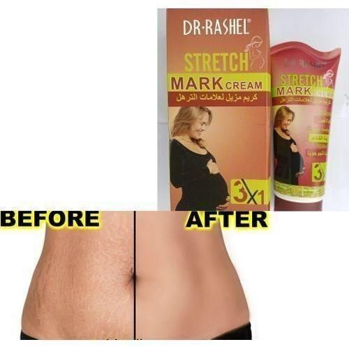 Dr. Rashel Stretchmark Removal Cream,,PLUS FREE GIFT.