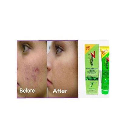 7 Miracles Spot Remover Cream