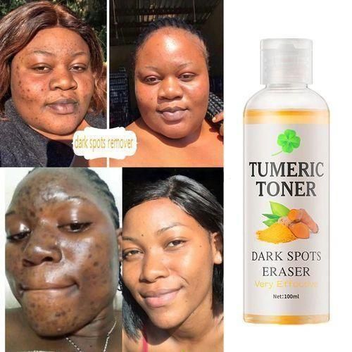 Tumeric Dark Spots Corrector Melasma Remover Tumeric Serum Acne Remover