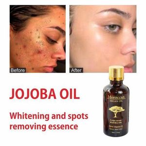 Moroccan Argan Oil Anti Aging Whitening Vitamin C Jojoba Oil Serum