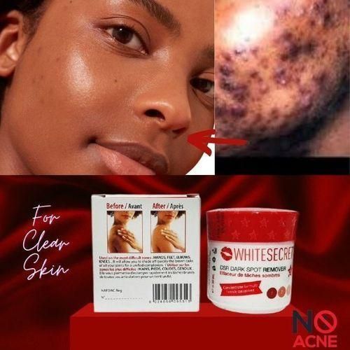 White Secret Dark Spot Remover