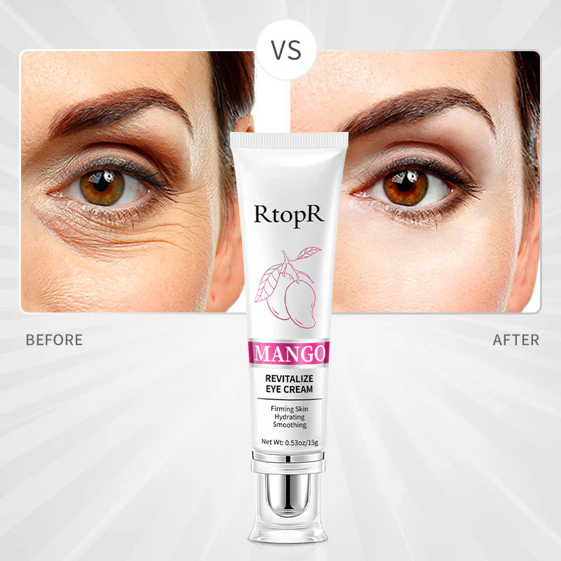 RTOPR Mango Revitalize Firming Eye Cream (15 g)