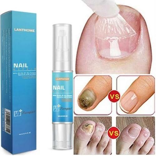 Lanthome Nail Fungus Removal Serum Pen — 35% OFF | Kill Nail Fungus, Repair Damaged Nails & Restore Healthy Clear Nails!