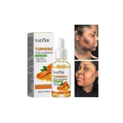 SADOER Tumeric Dark Spot Corrector Serum Dark Spot Remove Acne Pimple Remover Serum -30ml