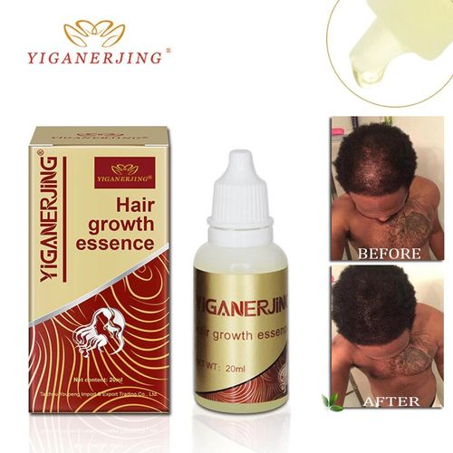 YIGANERJING Original Hair Growth Oil Fast Restoration Natural Hair Loss