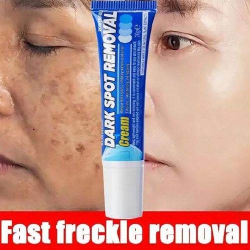 KORMESIC Dark Spot Removal Cream