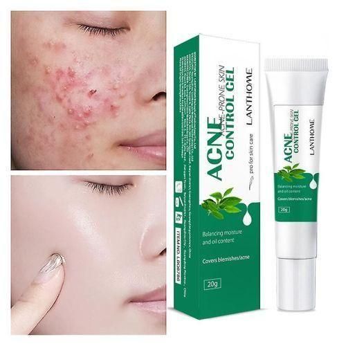 🔥 LIMITED DEAL — Lanthome Acne Control Gel | Removes Acne + Shrinks Pores + Clears Blemishes | KSh 1,800