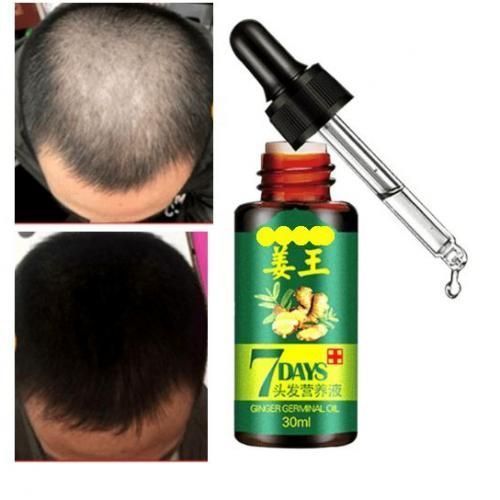 Aichun Beauty 7Days Gluta Ginger Germinal Hair Growth Essence