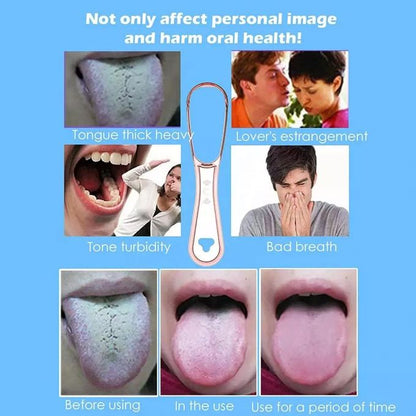 Tongue Scraper – 100% BPA Free Effective Tongue Brush Tool for Bad Breath Treatment