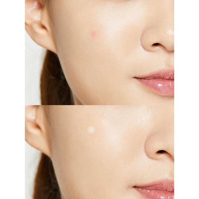 COSRX Acne Pimple Master Patch – 24 Patches