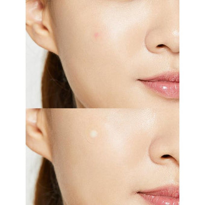 COSRX Acne Pimple Master Patch – 24 Patches