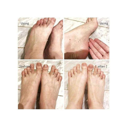 Vaseina Foot Peeling Spray