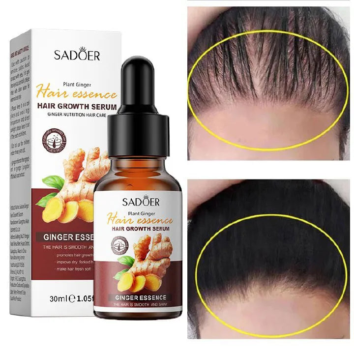 Sadoer Hair Growth Serum