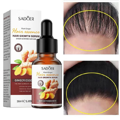 Sadoer Hair Growth Serum
