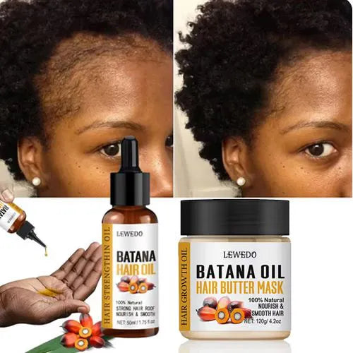 LEWEDO 2PCS Fast Hair Growth Oil Africa Crazy Traction Alopecia batana Hair Mask Anti Hair Break Hair Strengthener Hair Loss Treatment Spray