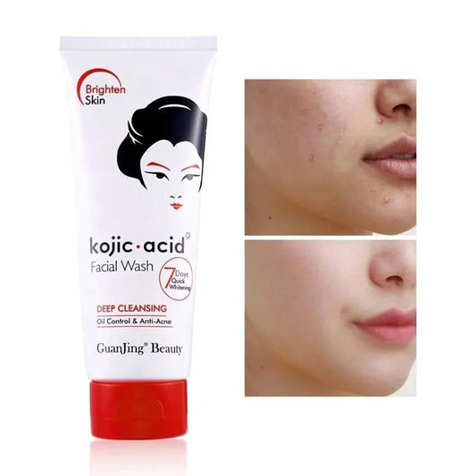 Guanjing Beauty Kojic Acid Facial Wash – 100g