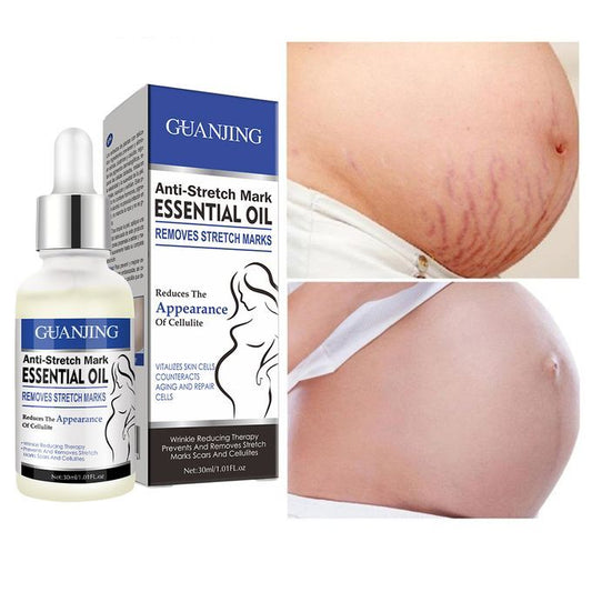 Guanjing Anti-stretch Mark Essential oil