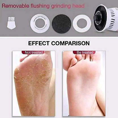 Electric Callus Remover – Rechargeable Foot Scrubber for Smooth, Soft Feet
