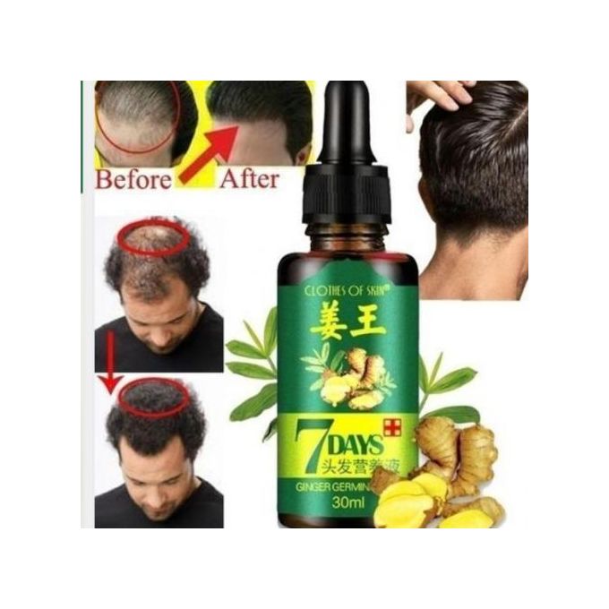 Clothes Of Skin 7Days Ginger Germinal Essential Hair Growth Oil For Hair Loss/Hair Treatment-For Both Men&Women30ml