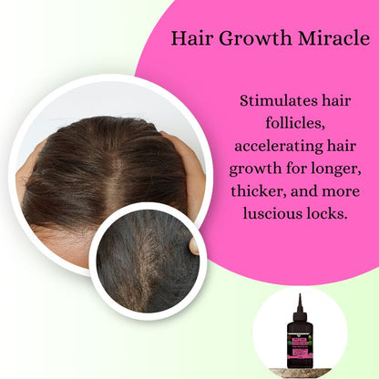 Mekis 4-in-1 Hair Growth Miracle Oil – Chebe, Amla, Rosemary & Peppermint