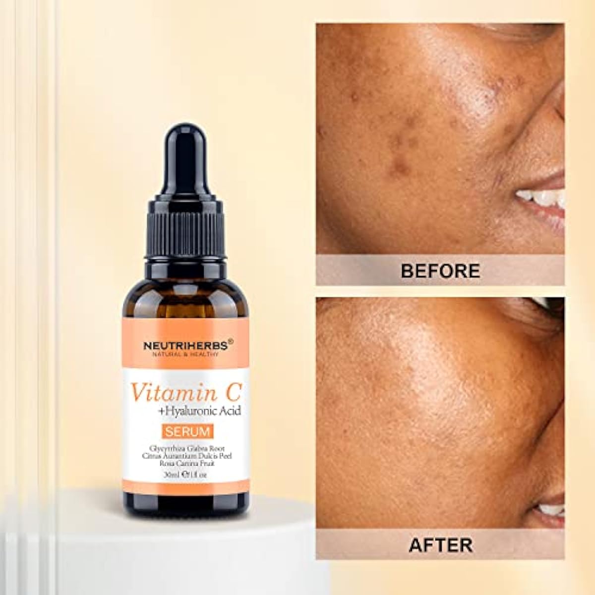 Neutriherbs Vitamin C Serum