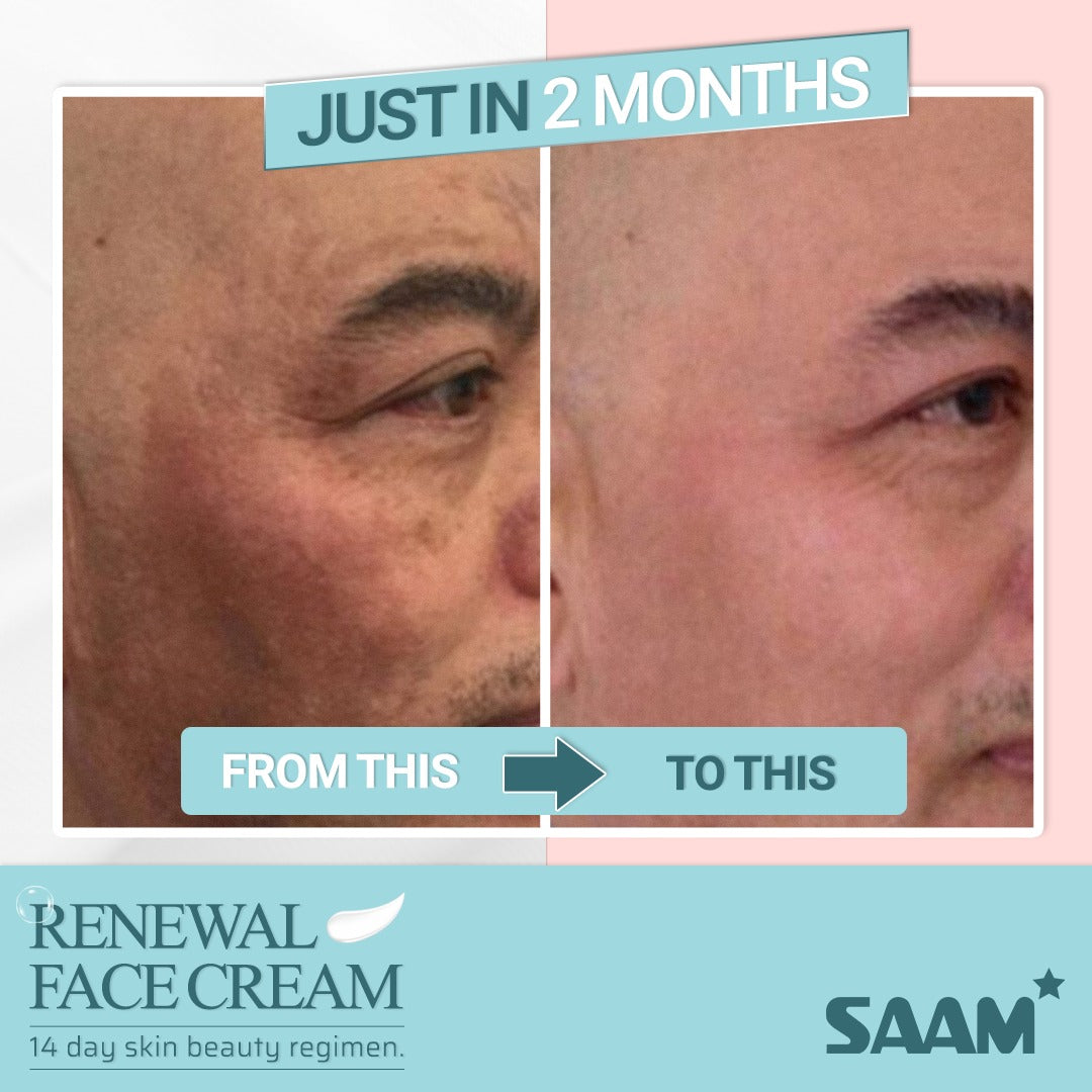 Sam Cream ORIGINAL Saam Renewal Face Cream – Starsam Naturals