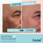 🔥ORIGINAL Saam Renewal Face Cream with QR CODE , BUY 1 GET 1 EXTRA FREE 🔥