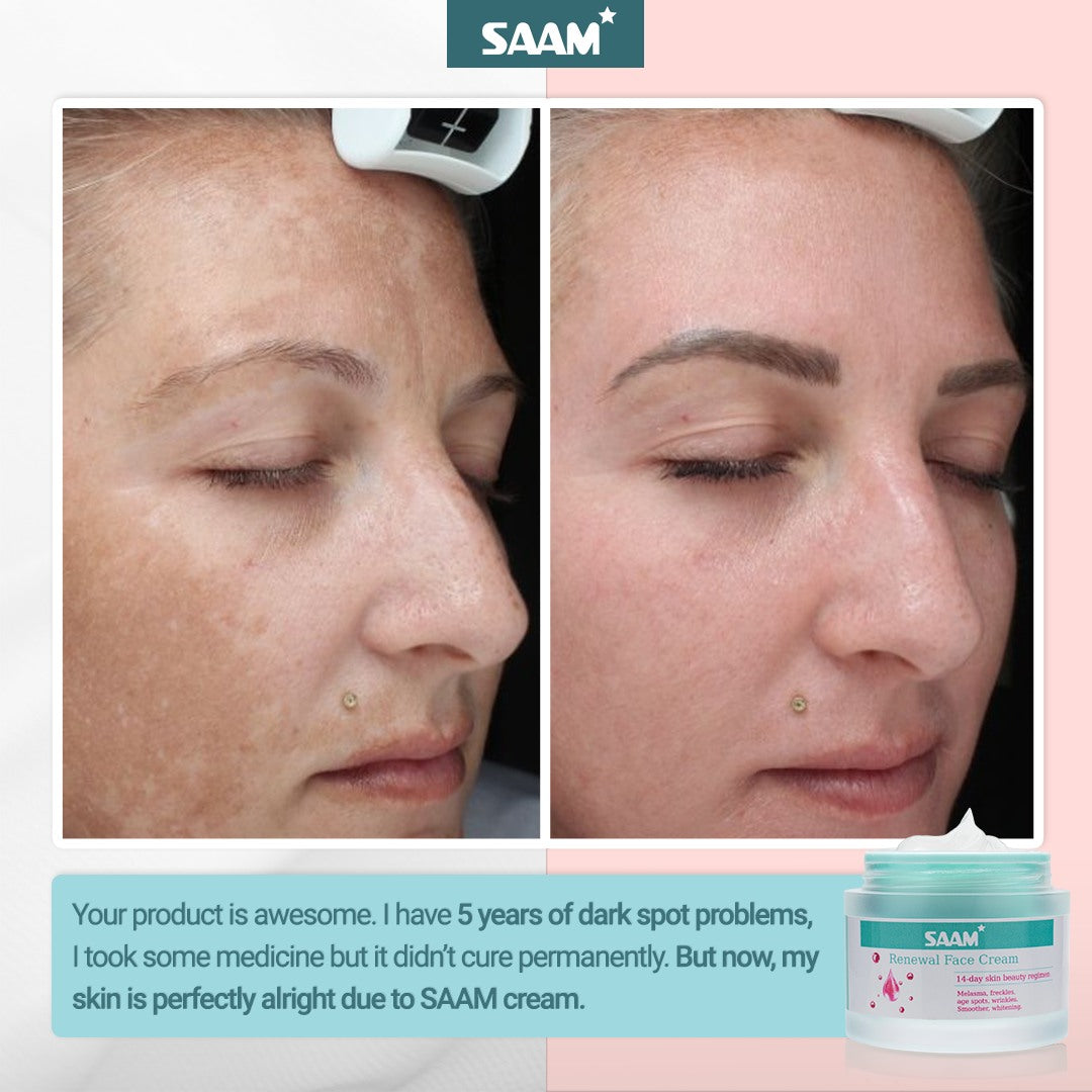 Sam Cream ORIGINAL Saam Renewal Face Cream – Starsam Naturals