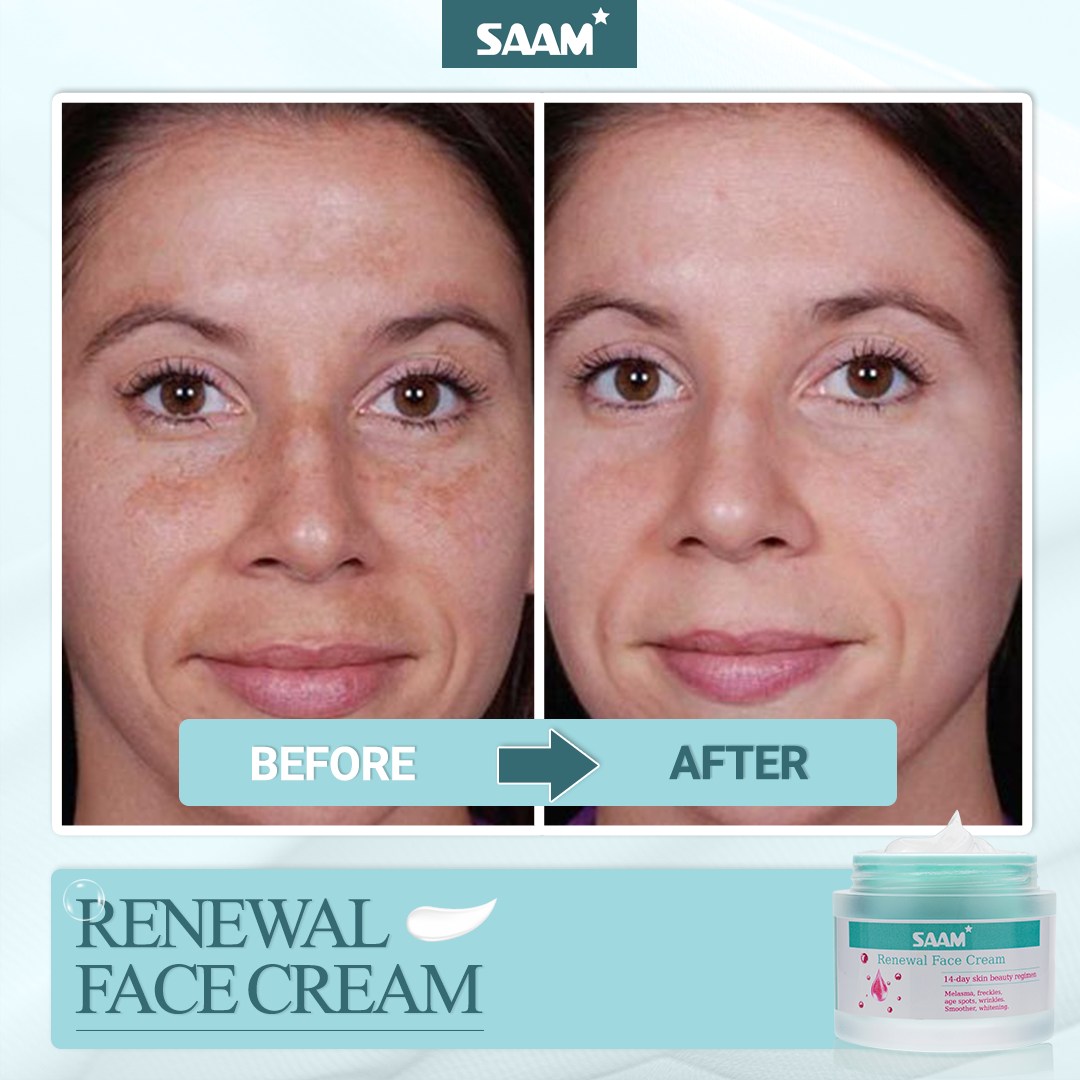 Sam Cream ORIGINAL Saam Renewal Face Cream – Starsam Naturals