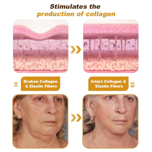 🔥 LIMITED DEAL — Botox Bee Venom Anti-Wrinkle Cream | Lifts & Firms + Erases Fine Lines + Restores Youthful Glow | KSh 2,000