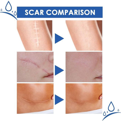 JAYSUING Scar Removal Cream