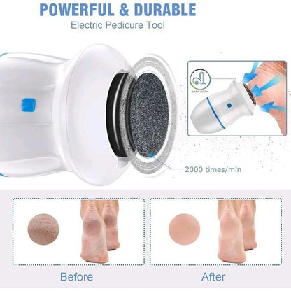 Electric Callus Remover – Rechargeable Foot Scrubber for Smooth, Soft Feet