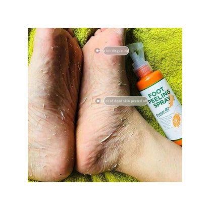 Vaseina Foot Peeling Spray