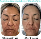 🔥ORIGINAL Saam Renewal Face Cream with QR CODE , BUY 1 GET 1 EXTRA FREE 🔥