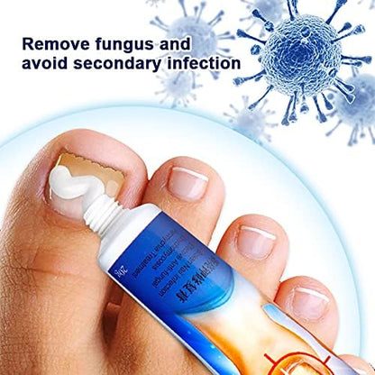 SUMIFUN Nail Fungus Treatment Cream